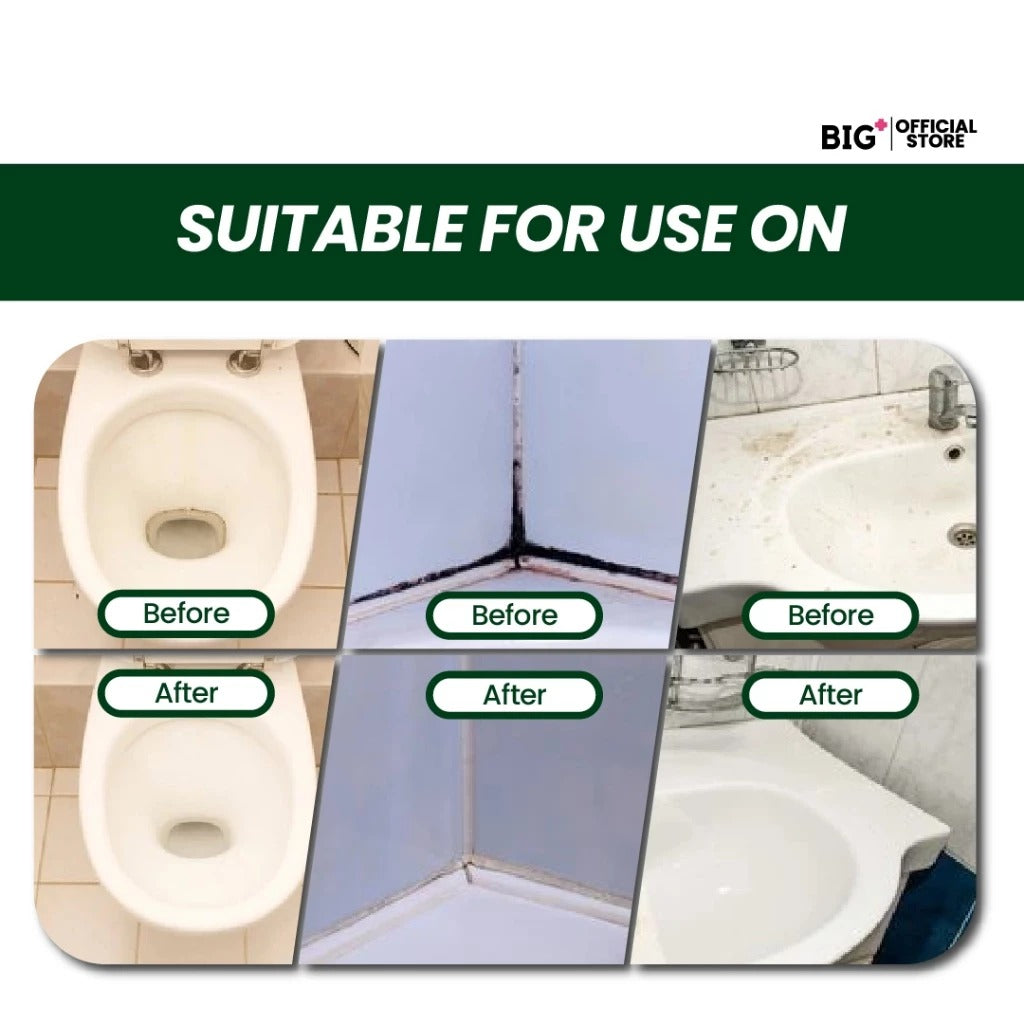 BIG+ Stain Removal Set